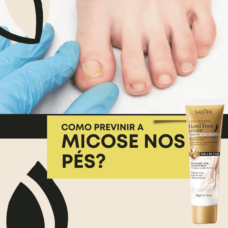 Creme Mágico para os Pés: Sua Solução Completa para Pés Saudáveis - Pés Confortáveis